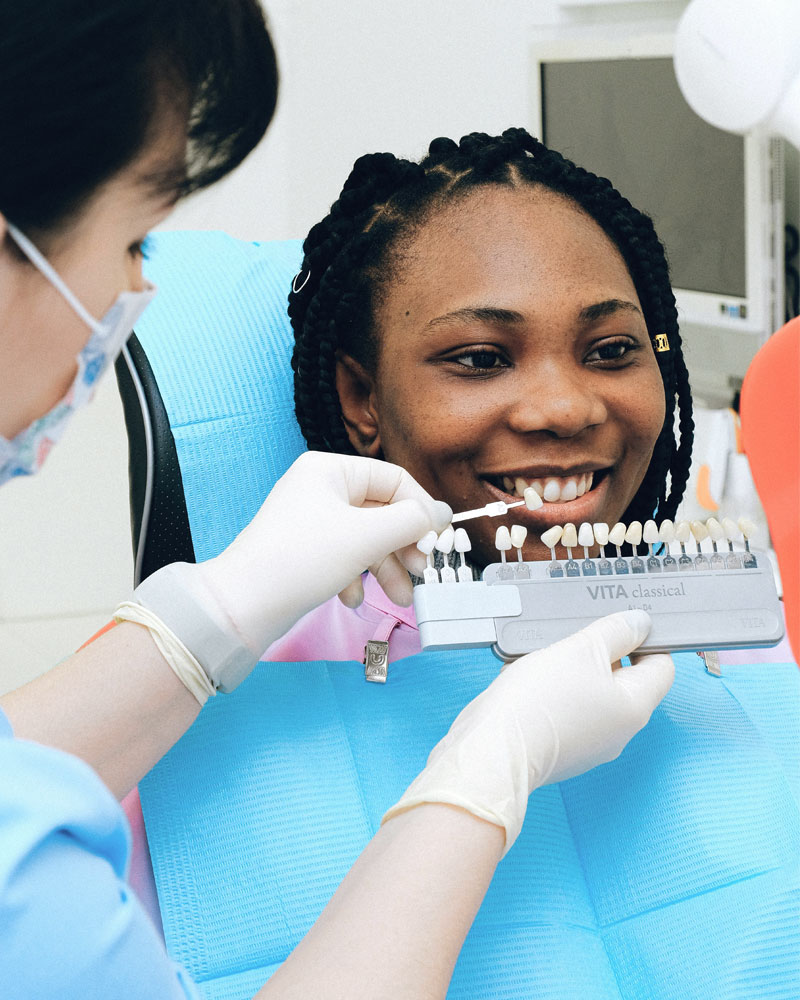 Comparing shades for teeth whitening