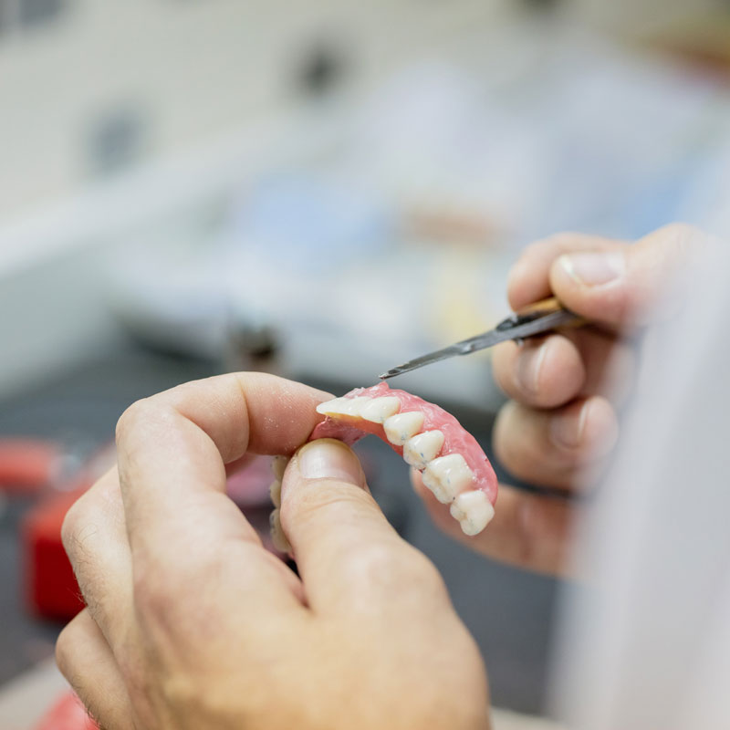 Repairing dentures