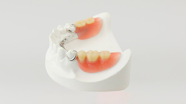 Partial Dentures