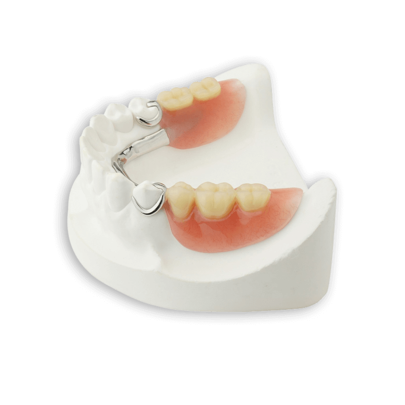 Removable Partial Dentures